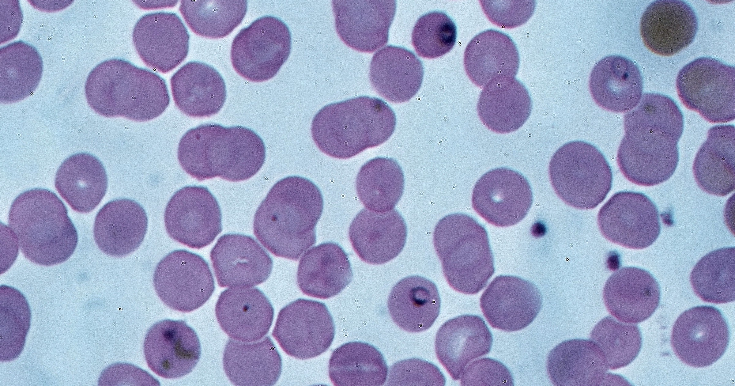 plasmodium-mutasjoner
