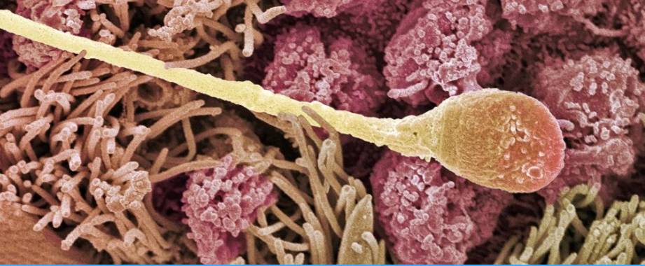 Sperm-info